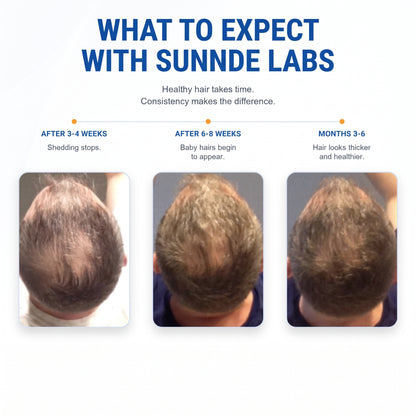 Sunnde Labs PepStack+™ Infusion Kit For Hair Regrowth