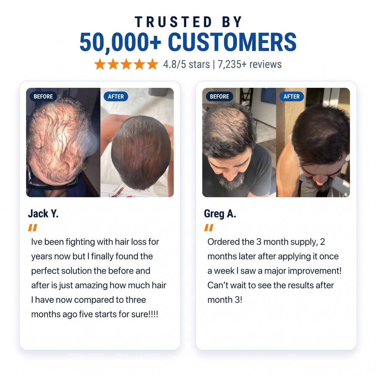 Sunnde Labs PepStack+™ Infusion Kit For Hair Regrowth