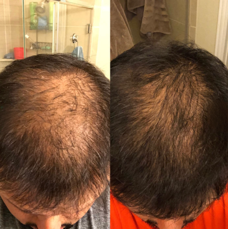 Before and after results