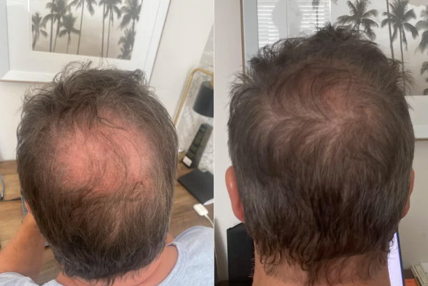 Before and after results